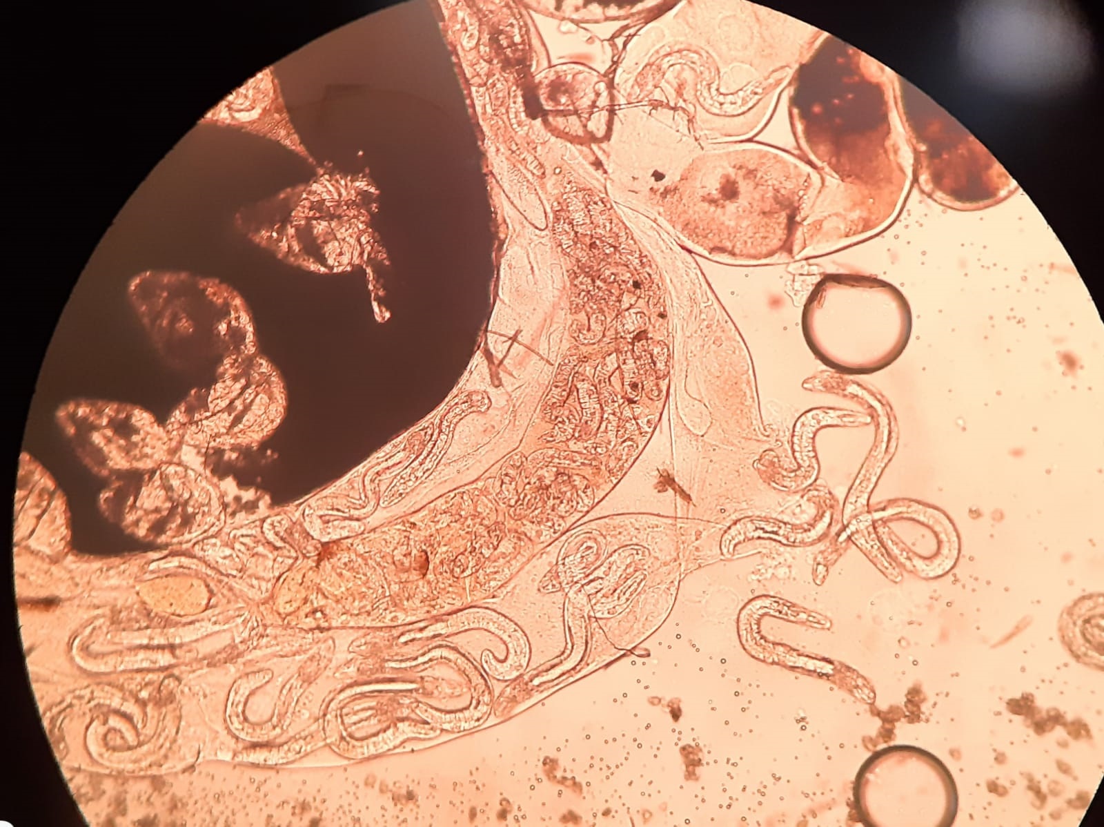 Дирофилярии под микроскопом.jpg
