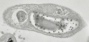 Ученые ТГУ описали бактерию, «застывшую» во времени, и нашли её родственника 