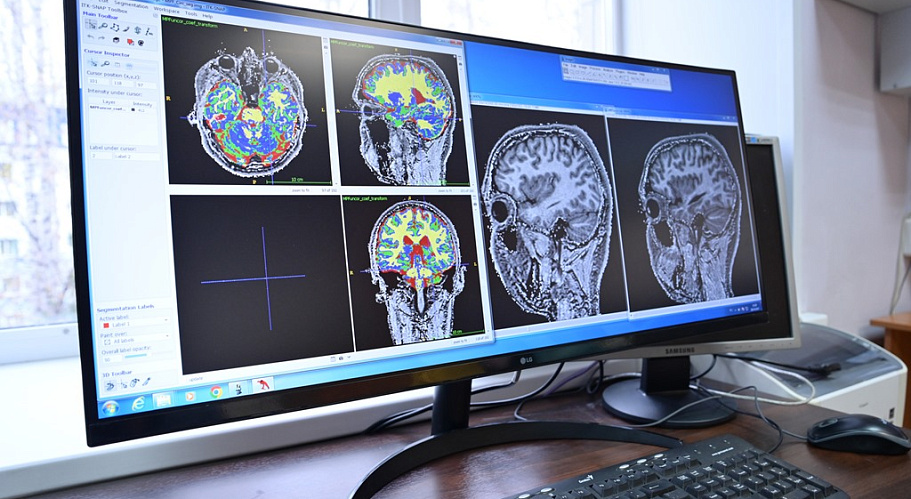 Нейробиологи ТГУ создают «атлас» головного мозга человека