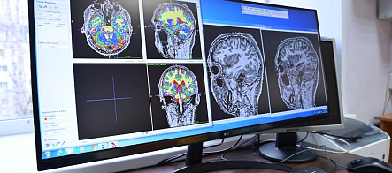 Нейробиологи ТГУ формируют «атлас» головного мозга человека